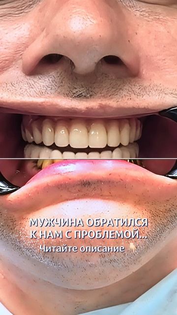 Кейс пациента