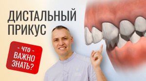 ДИСТАЛЬНЫЙ ПРИКУС. ЧТО ВАЖНО ЗНАТЬ?