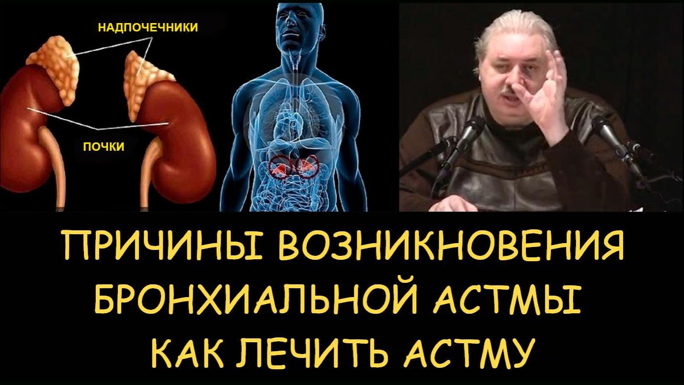 ✅ Н.Левашов. Причины возникновения бронхиальной астмы. Как лечить астму