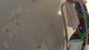 ВИДЕО ДО ОПЕРАЦИИ