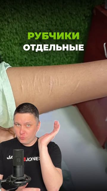 Блог про удаление ПМ и тату!  Подписывайся! #лазерноеудалениятату #перманентныймакияж #татуаж