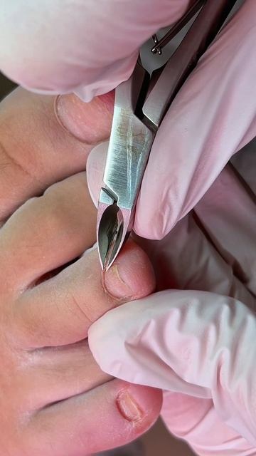 обработка подногтевых мозолей, главное выдирать 🙌🏻