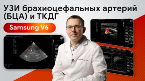 Samsung V6 в диагностике сосудов: сканирование брахиоцефальных артерий и ТКДГ