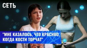 Цифровая зависимость привела к анорексии. Сеть