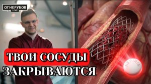Срочно, перестань трамбовать свои сосуды жиром, аспирин тебе с этим поможет