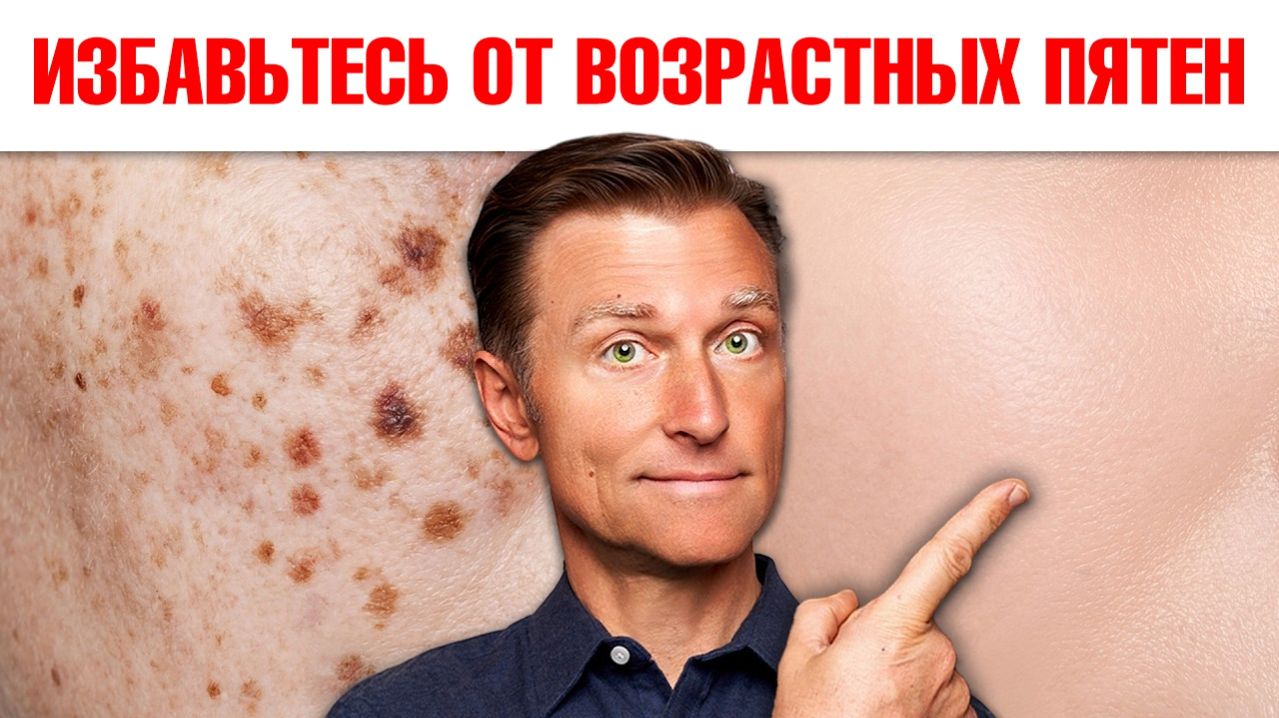 Возрастные пигментные пятна: РЕАЛЬНЫЕ причины и решение