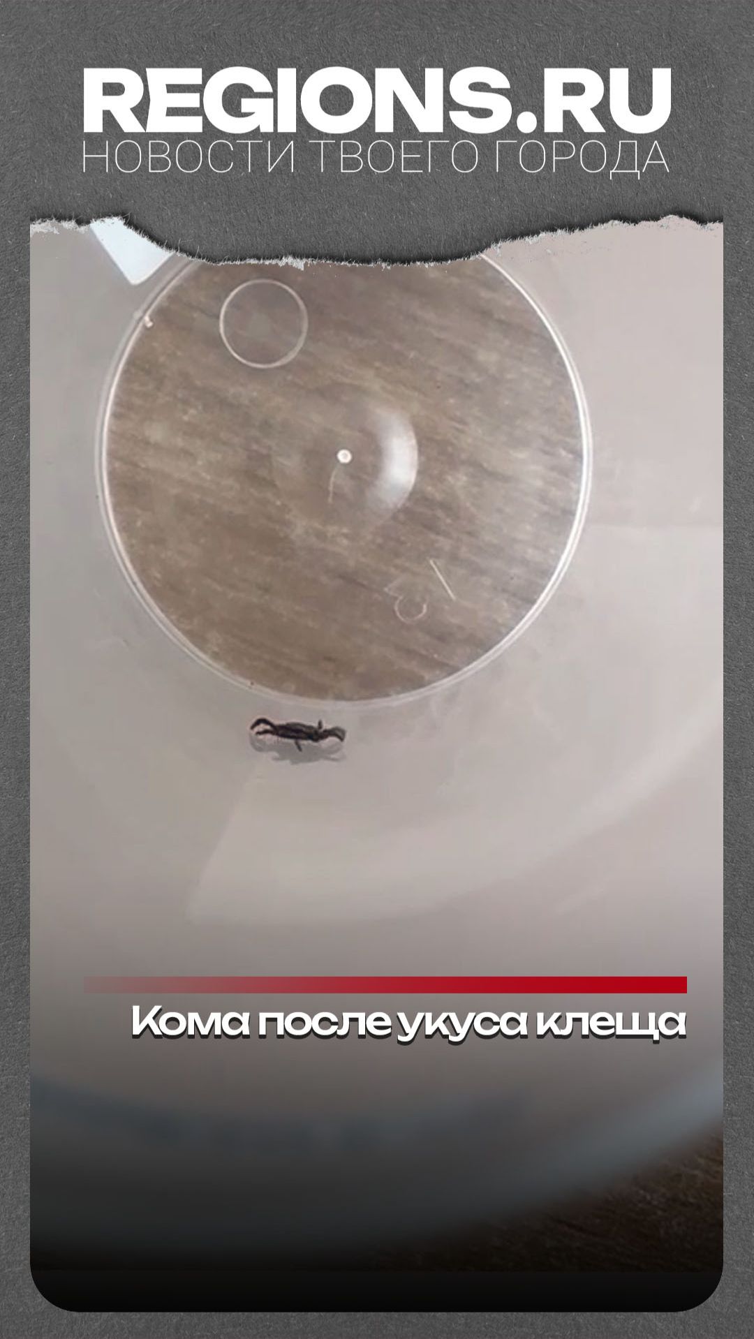 Кома после укуса клеща