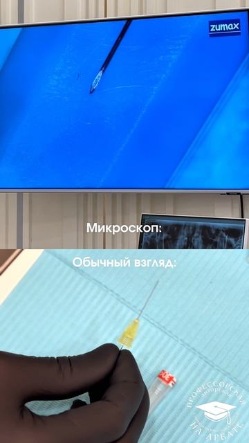 Почему мы используем микроскоп в лечении🎓