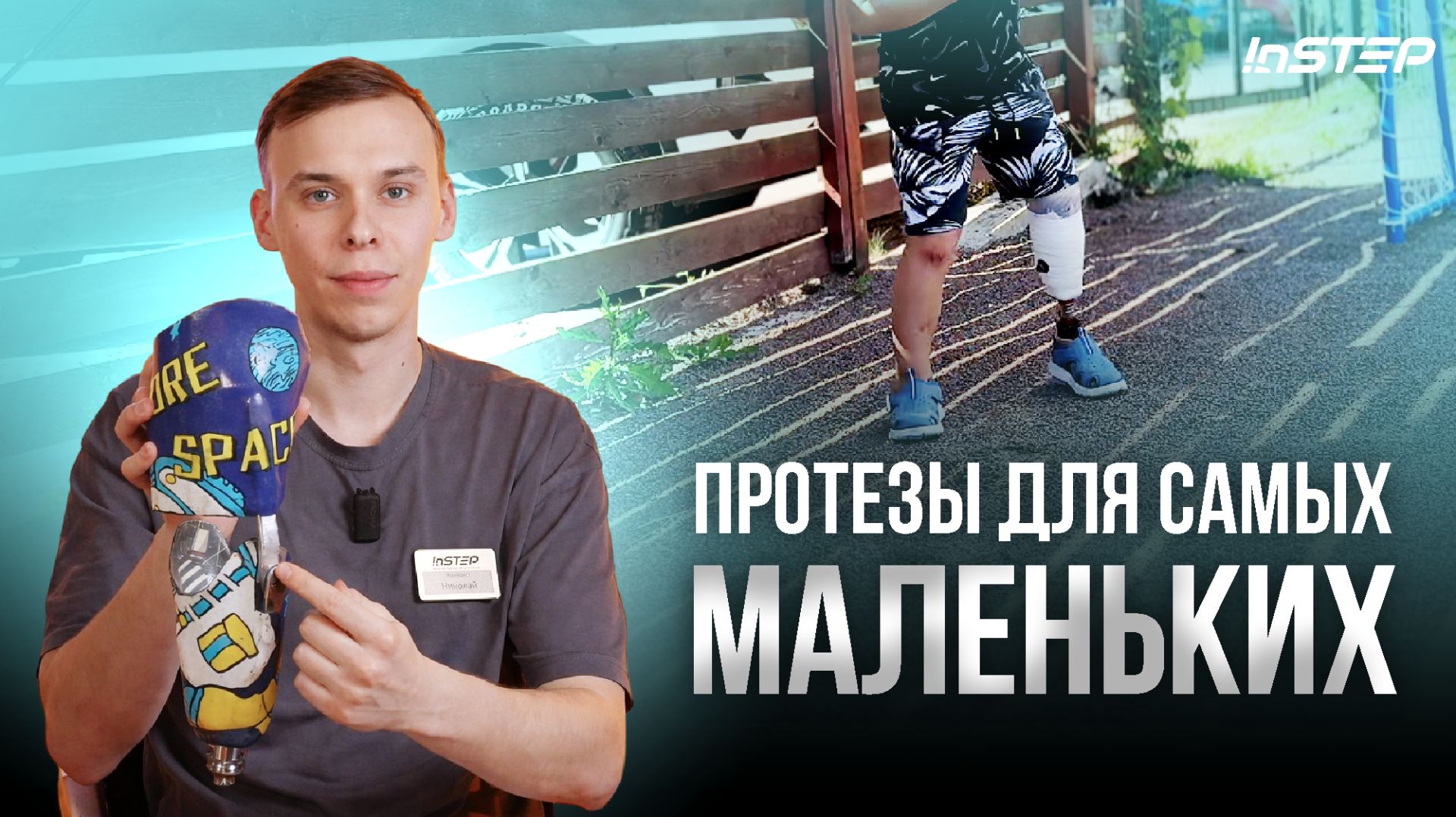 Детское протезирование: Как часто нужно менять гильзу? Отвечает протезист