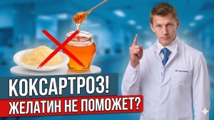 Коксартроз: 5 мифов домашнего лечения, которые не работают!
