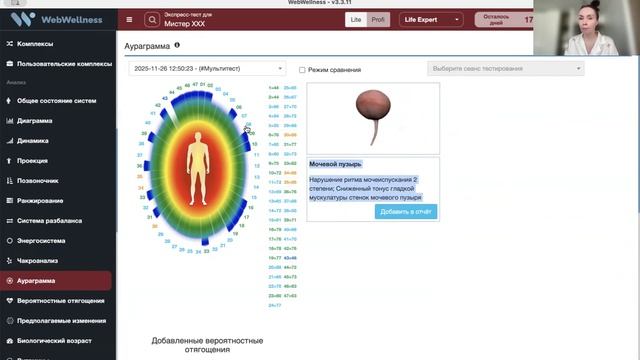 Обзор возможностеи раннеи оценки здоровья