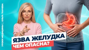 Стресс и язва желудка: правда и мифы. Что действительно вызывает язву?