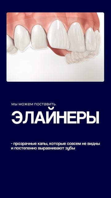 Я НЕ ХОЧУ СТАВИТЬ БРЕКЕТЫ СВОЕМУ РЕБЕНКУ