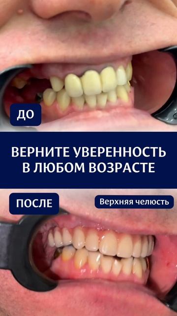 Кейс пациента