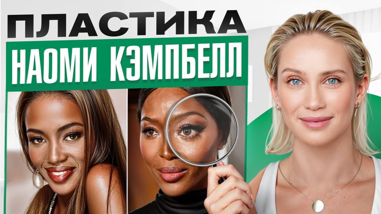 Наоми Кэмпбелл. Вечная молодость? Генетика? А может, аккуратная пластика?