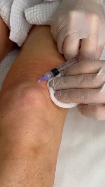 Секрет подтянутых и ухоженных коленей