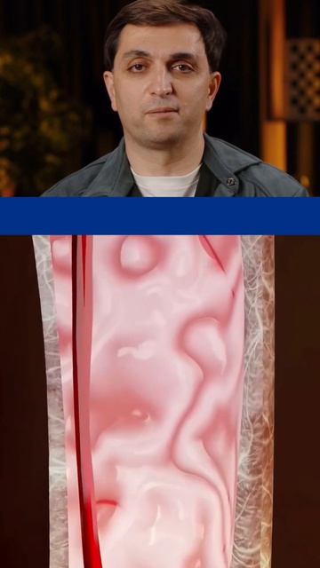 Что делать если проглотили кусочек стекла