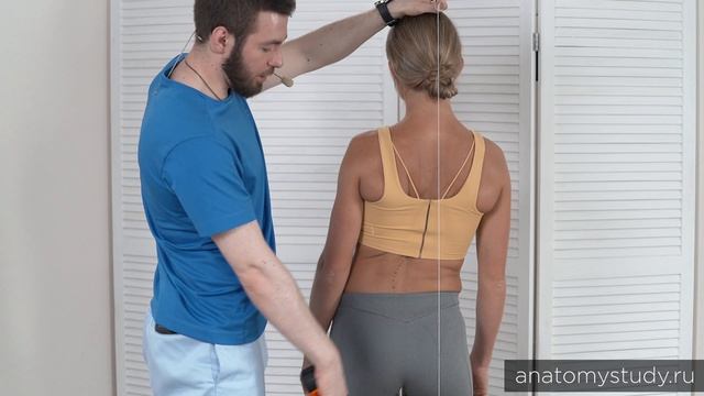 Фронтальный дисбаланс при сколиозе: как его увидеть и оценить