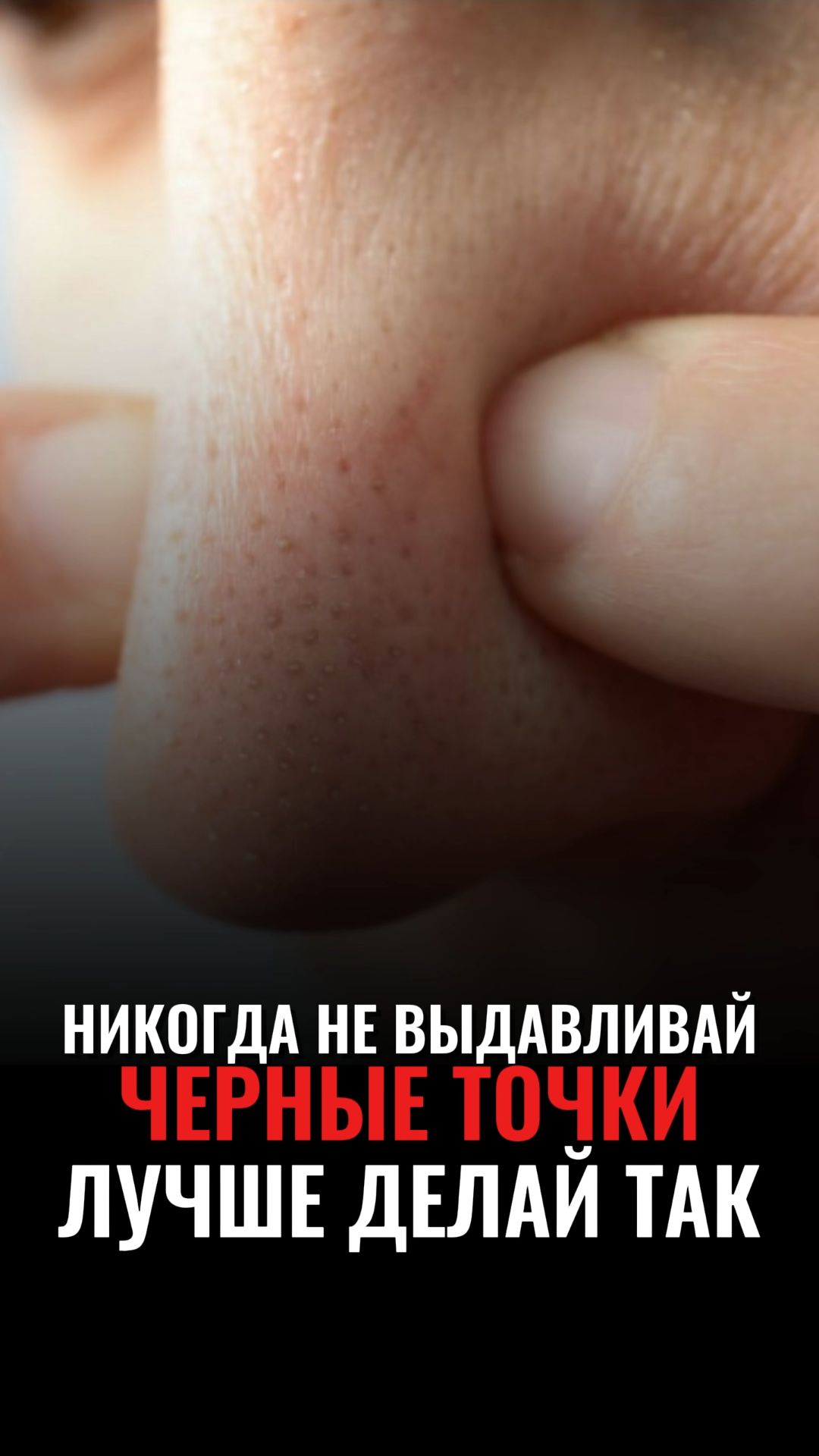 Как реально избавиться от черных точек на носу?