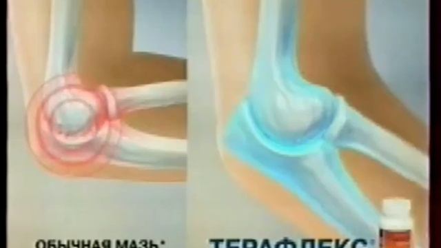 Рекламный блок и анонсы (Россия 1, 16.04.2011)