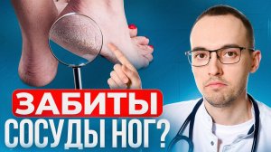 5 признаков забитых сосудов ног. Как проверить дома без врача?
