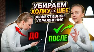 Ровная и красивая шея: избавляемся от холки