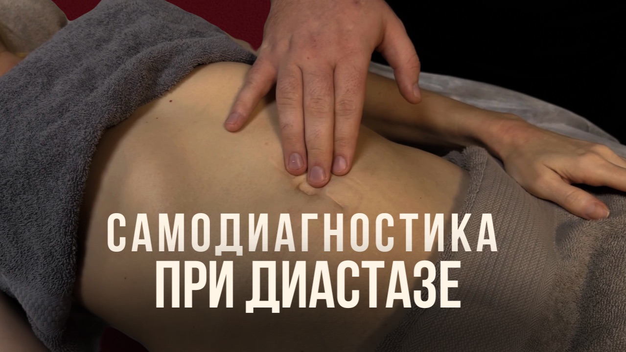 Торчит живот? ПРОВЕРЬ СЕБЯ на диастаз! Восстановление после родов.