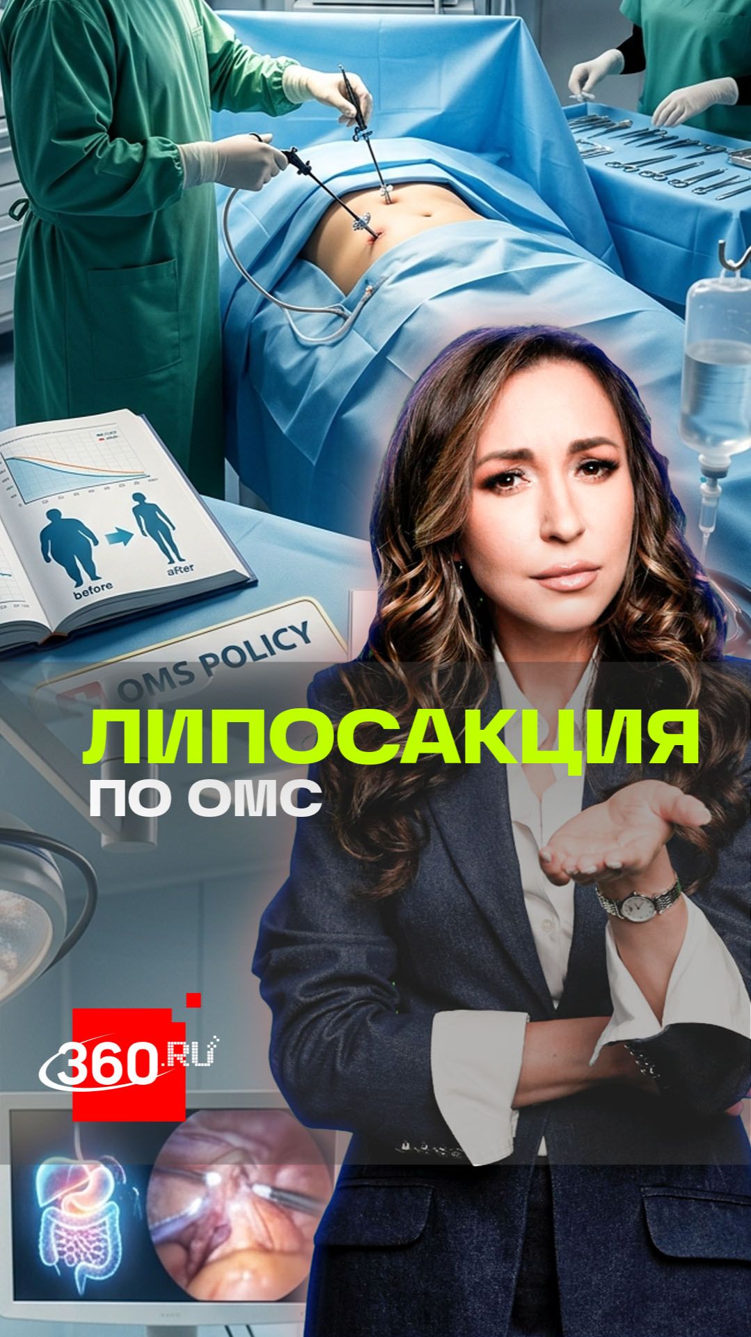 Липосакция, уменьшение желудка: какие операции для борьбы с ожирением теперь предусматривает ОМС?