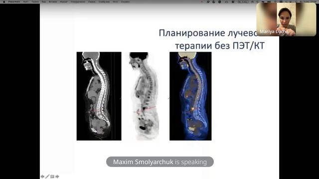 ПЭТ КТ при диагнозе рак шейки матки.