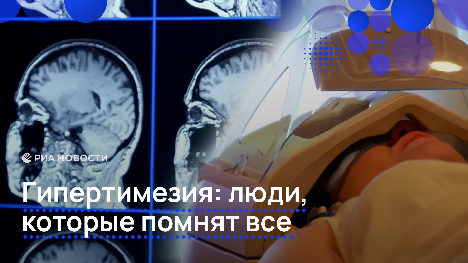 Гипертимезия: люди, которые помнят все