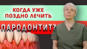 Пародонтит: почему современные стоматологи перестали бороться за зубы до конца?
