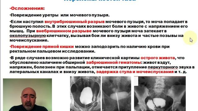 Лекция : Хирургические заболевания и повреждения таза часть 3