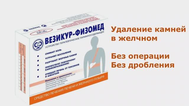 Удаление камней из желчного без дробления смотреть онлайн