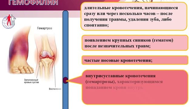 17 апреля- Всемирный день борьбы с гемофилией