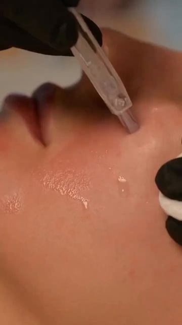 Процедура которую Фролова Мария Викторовна косметолог- эстетист называет синонимом здоровья кожи.