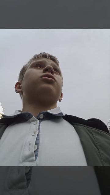 мне сняли перелом