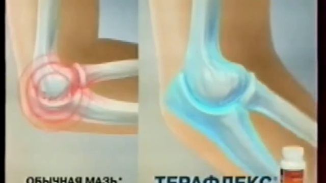 Рекламный блок и анонсы (Россия 1, 16.04.2011) наоборот