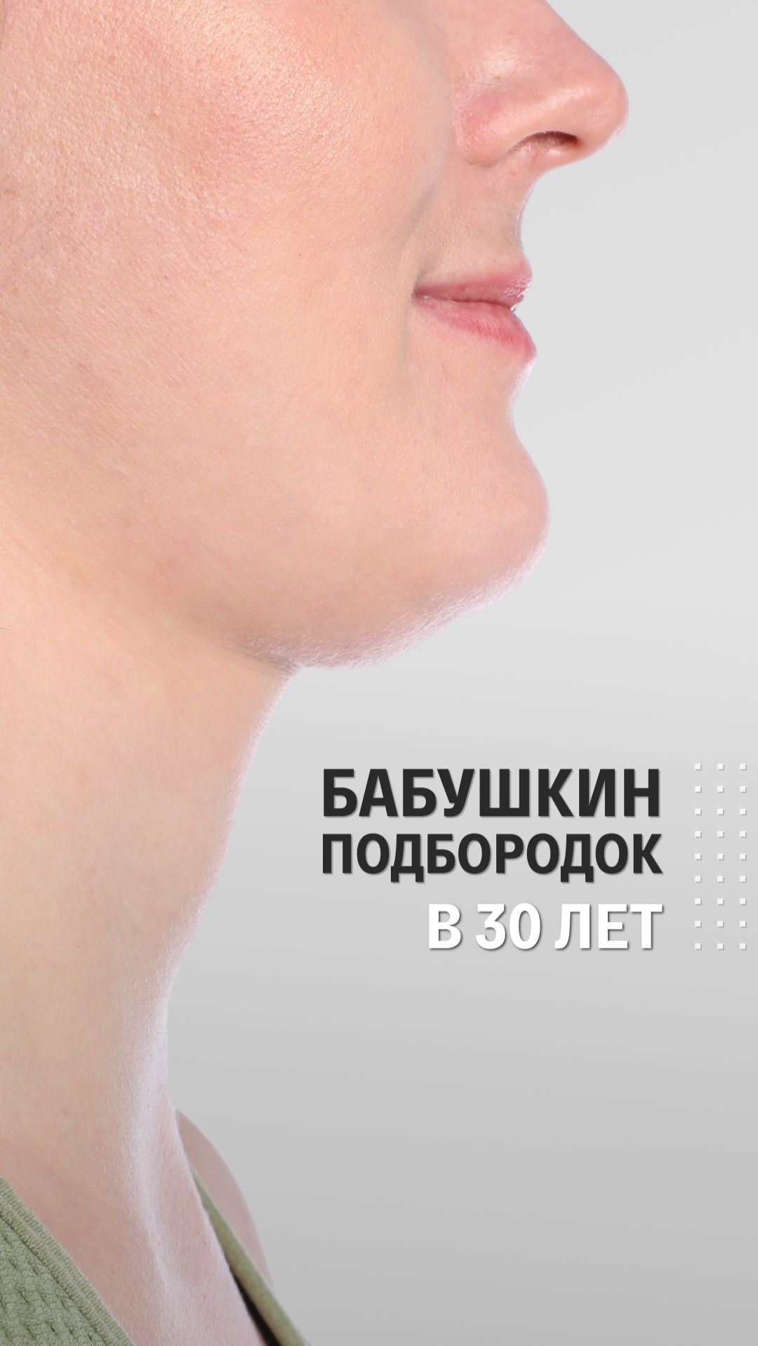Бабушкин подборок в 30 лет  Что делать со вторым подбородком