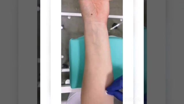 Кожные прик-тесты