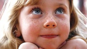 " Веснушки "