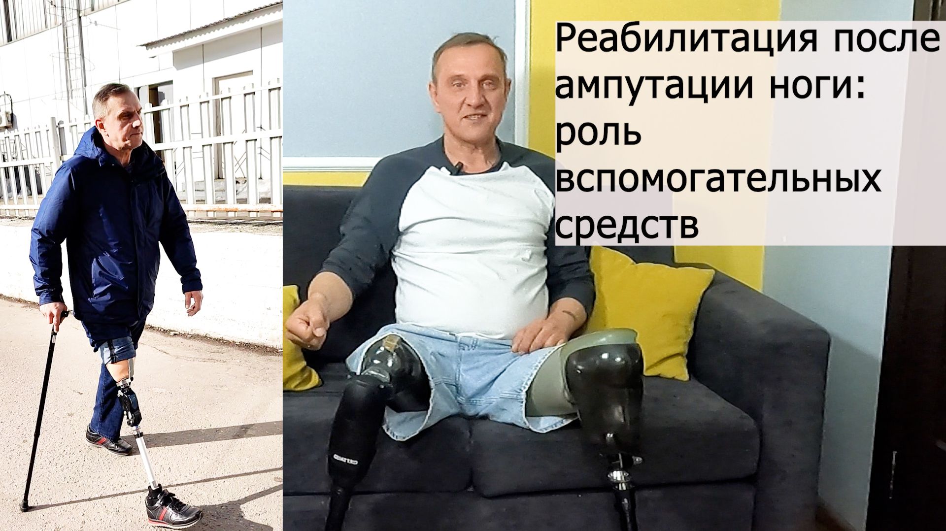 Реабилитация после ампутации ноги: роль вспомогательных средств.