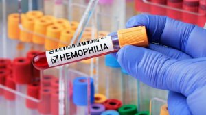 Как в Таджикистане поддерживают пациетов с гемофилией?