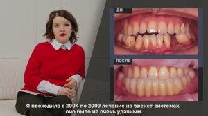 NKclinic - отзывы пациентов. Удаление сверхкомплектных зубов с последующей имплантацией.