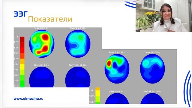 Нейрокогниция