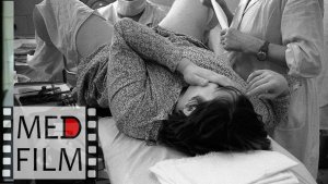 2. Тазовое предлежание ©