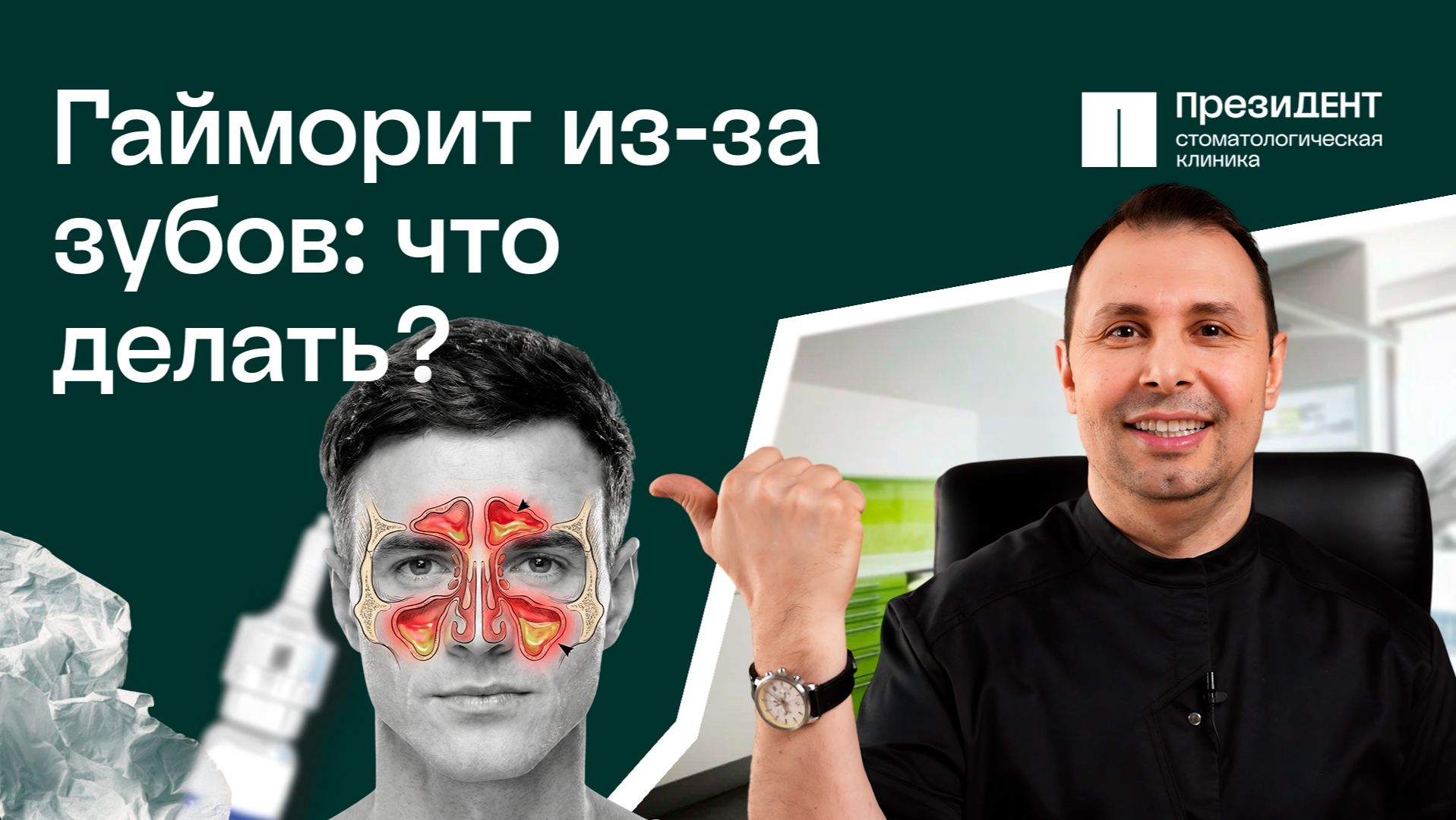 Не могу вылечить гайморит! Дело в зубах. ЛОР - стоматология: симптомы и лечение  ПрезиДЕНТ