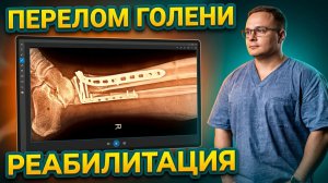 ПЕРЕЛОМ БОЛЬШЕБЕРЦОВОЙ КОСТИ | После Операции | Доктор Юршин