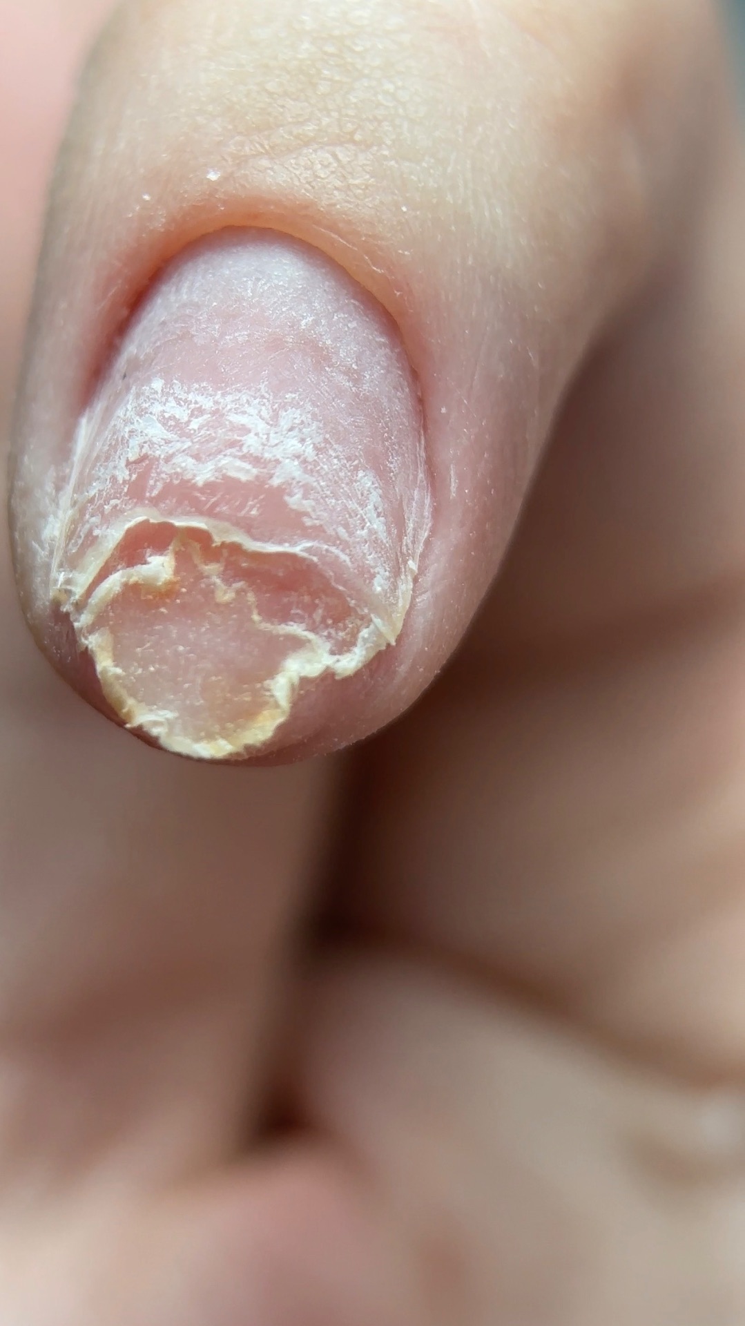 Наращивание по воздуху