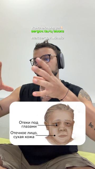 Гипотиреоз