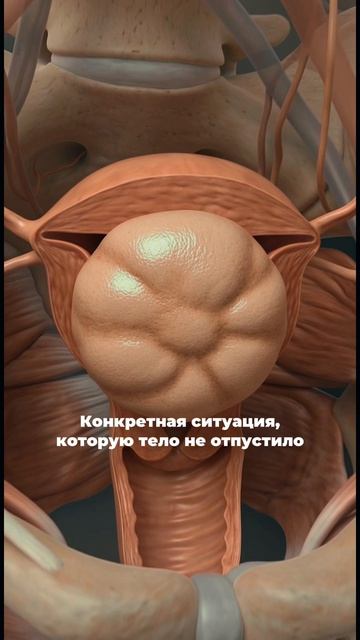 Вы ищете, как лечить миому